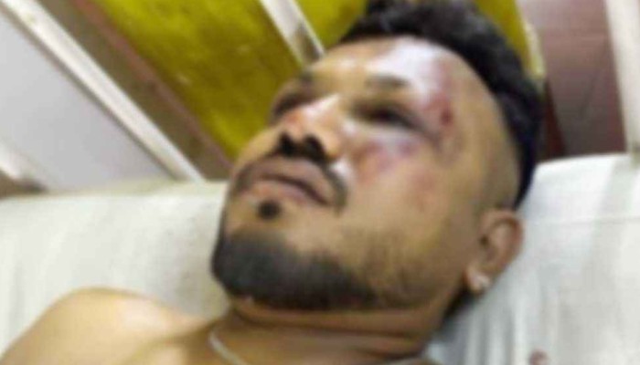 ​বিমান বিধ্বস্তে বেঁচে গেলেন এক যুবক