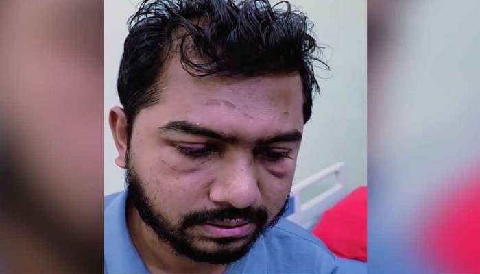 নুরের শারীরিক অবস্থা নিয়ে সবশেষ যা জানা গেল