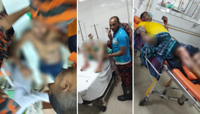 ​টঙ্গীতে আগুন নেভাতে গিয়ে দগ্ধ ৫ ফায়ার ফাইটার