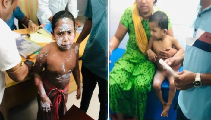 ​গ্যাস লিকেজ থেকে বিস্ফোরণ, একই পরিবারের চারজন দগ্ধ