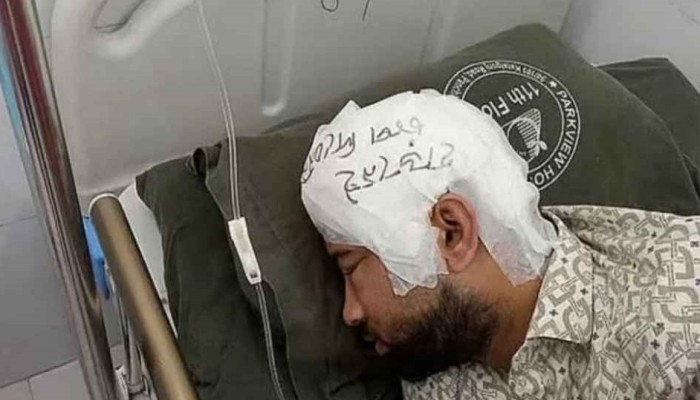 ​ফ্রিজে রাখা মাথার খুলি ২ মাস পর মামুনের মাথায় প্রতিস্থাপন