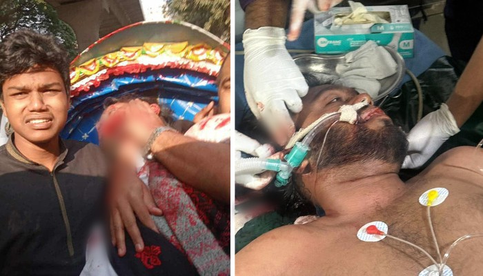 ‘লাইফ সাপোর্টে’ গুলিবিদ্ধ ওসমান হাদি