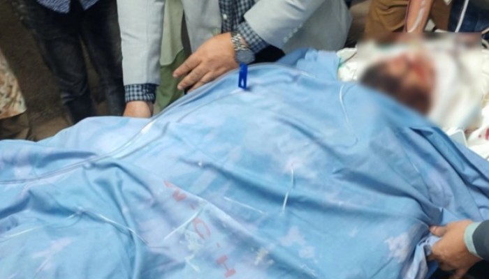 ‘হাদির ম্যাসিভ ব্রেন ইনজুরি, আগামী ৭২ ঘণ্টা অত্যন্ত ঝুঁকিপূর্ণ’