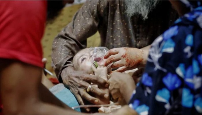 দেশজুড়ে হামের প্রাদুর্ভাব: আক্রান্ত ৬৪৭৬, মৃত্যু ১১৪