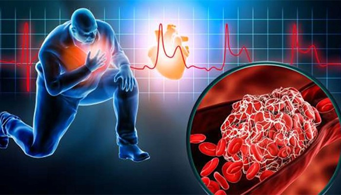 ​হৃদরোগের ঝুঁকি এড়াতে কোলেস্টেরল নিয়ন্ত্রণ করবেন যেভাবে