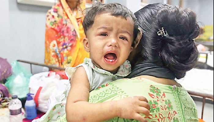 ​হাম ও উপসর্গে আরও ১২ মৃত্যু