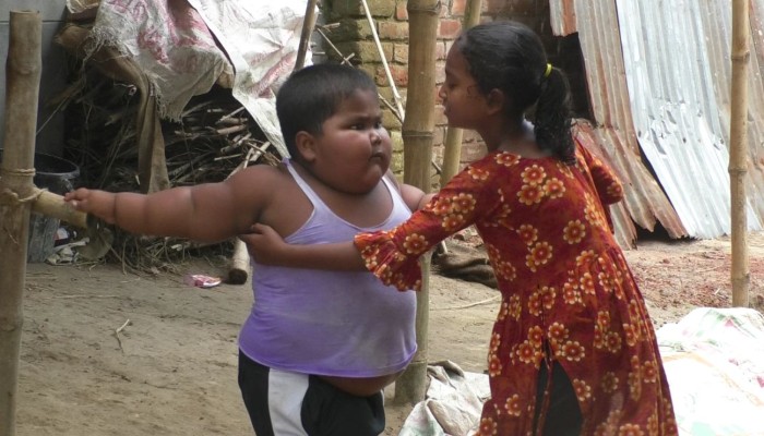 চার  বছরের শিশুর ওজন ৫২ কেজি!