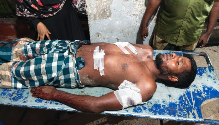 কলাপাড়ায় গরু ব্যবসায়ীকে কুপিয়ে ৭২ হাজার টাকা ছিনতাই